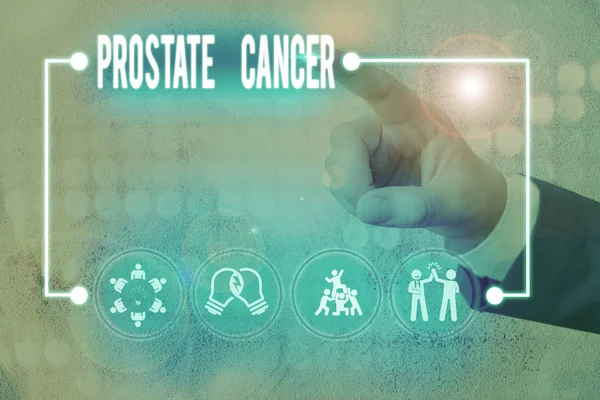 Writing note showing Prostate Cancer. Business photo showcasing cancer develops in the gland of male reproductive system. — Stock Photo, Image