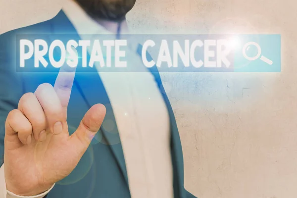 Word writing text Prostate Cancer. Business concept for cancer develops in the gland of male reproductive system.