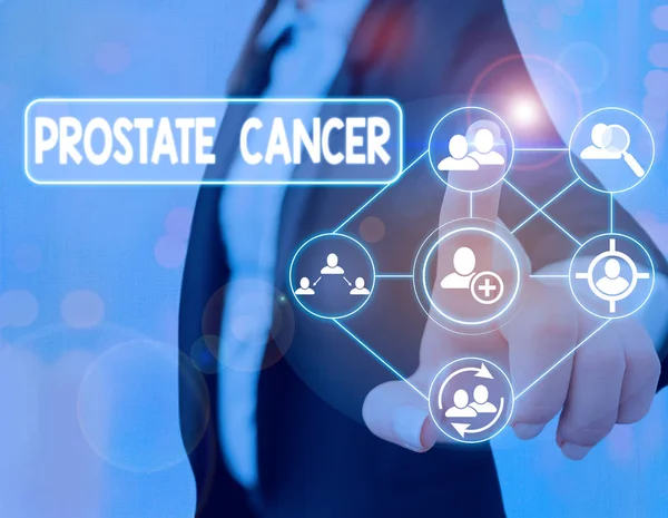 Text sign showing Prostate Cancer. Conceptual photo cancer develops in the gland of male reproductive system. — Stock Photo, Image