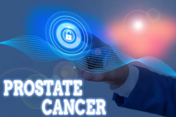 Writing note showing Prostate Cancer. Business photo showcasing cancer develops in the gland of male reproductive system. — Stock Photo, Image