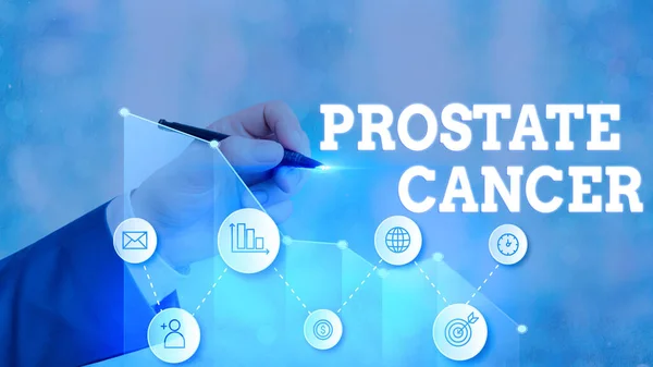 Word writing text Prostate Cancer. Business concept for cancer develops in the gland of male reproductive system. — Stock Photo, Image