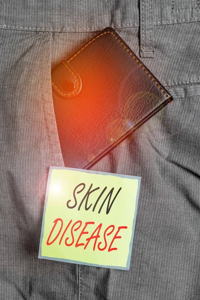 Text sign showing Skin Disease. Conceptual photo any of the diseases or disorders that affect the human skin Small little wallet inside man trousers front pocket near notation paper.