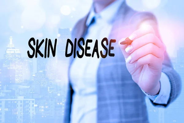문자 피부 질환을 쓰는 것입니다. 사람의 피부에 영향을 미치는 질병이나 장애에 대한 비즈니스 개념. — 스톡 사진