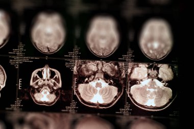 Manyetik rezonans görüntüleme arka plan, seçici odak. Kavramı tıbbi muayene.