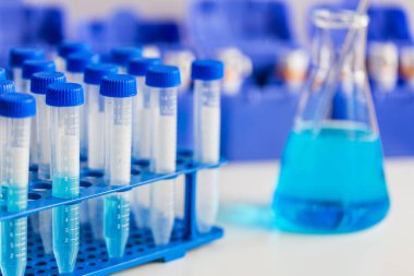 Tıbbi teşhis laboratuvarı. Test tüplerinde test edilecek malzemeden örnekler.