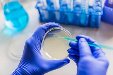 Tıbbi teşhis laboratuvarı. Mikrobiyoloji laboratuvarında mikrobiyolojik materyal kültürü..