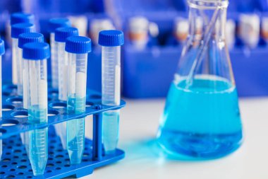 Tıbbi teşhis laboratuvarı. Test tüplerinde test edilecek malzemeden örnekler.