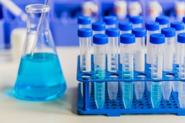 Tıbbi teşhis laboratuvarı. Test tüplerinde test edilecek malzemeden örnekler.