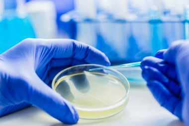 Tıbbi teşhis laboratuvarı. Mikrobiyoloji laboratuvarında mikrobiyolojik materyal kültürü..