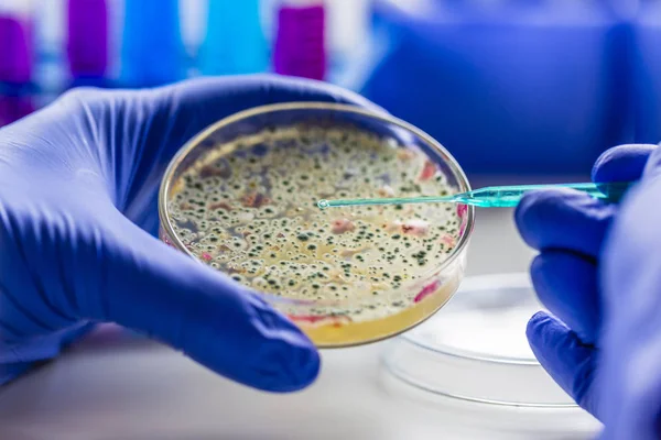 Tıbbi Teşhis Laboratuvarı Mikrobiyoloji Laboratuvarında Mikrobiyolojik Materyal Kültürü — Stok fotoğraf