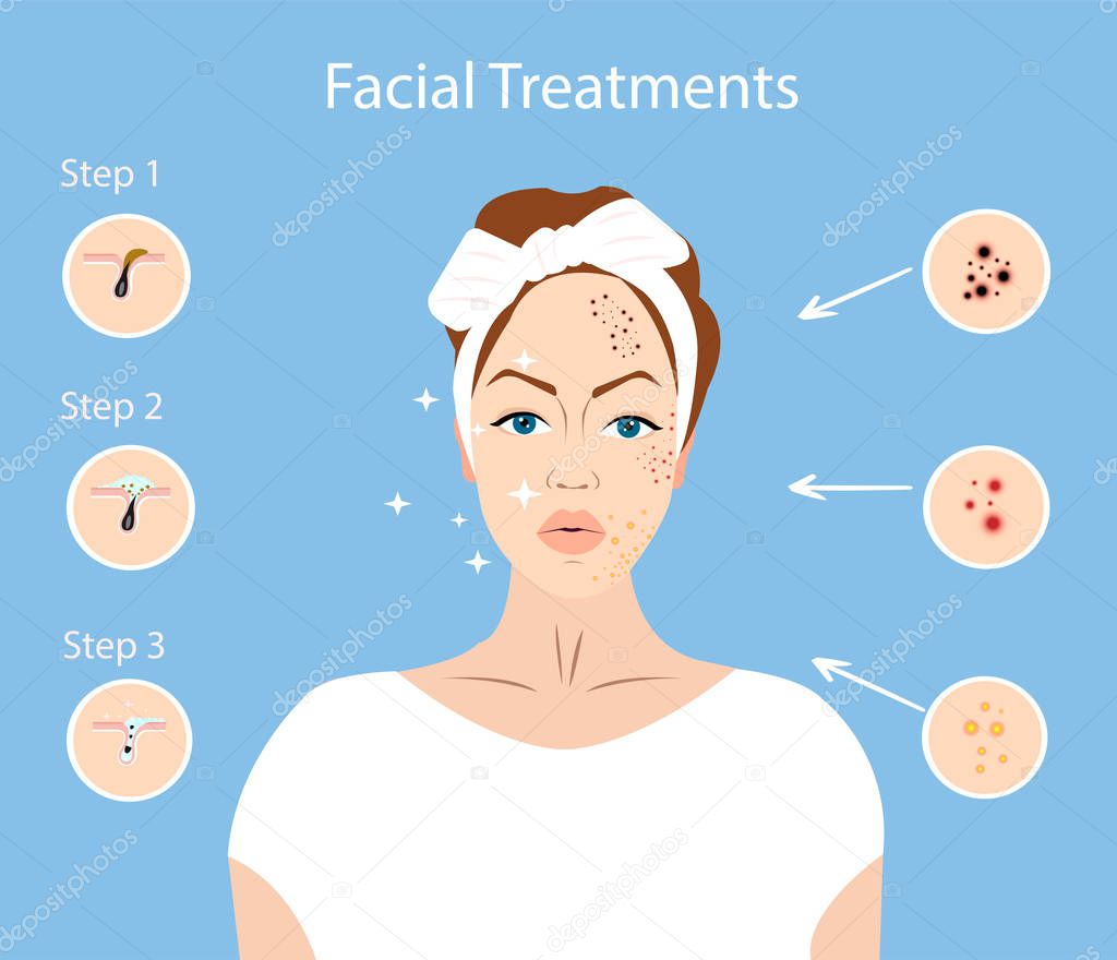 Vector of a young woman with face imperfections. 