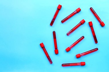 Mavi arka planda test tüplerindeki kan. Üst görünüm