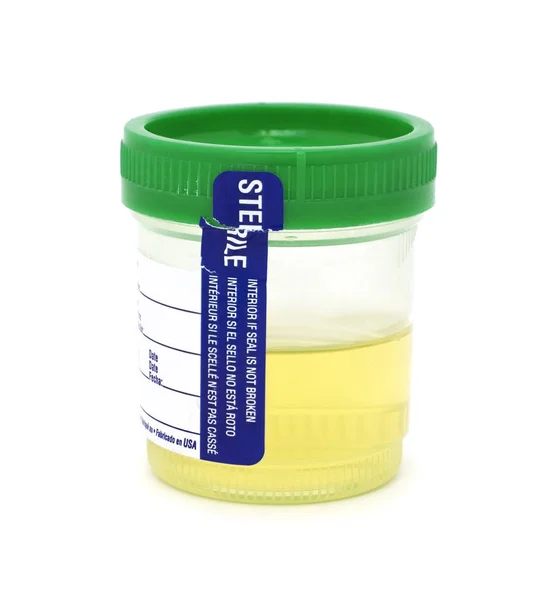 Isolato tazza campione di urina — Foto Stock