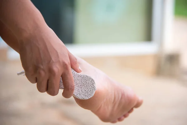 Foot Scrub yourself,cracked heel — Stock Photo, Image