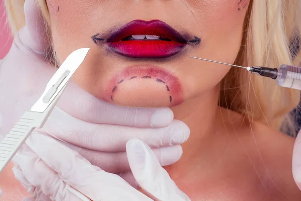 Retrato joven rubia sexy con flechas de línea en la cara sobre fondo de estudio. lifting de cuello y aumento de labios ácido hialurónico o mentoplastia — Foto de Stock