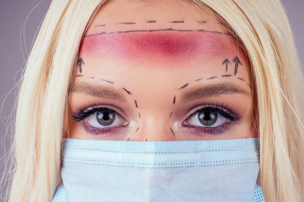 Bella donna barbie bionda in mani estetiste mediche con siringhe che fanno iniezione botox nel suo viso linee di primo piano — Foto Stock