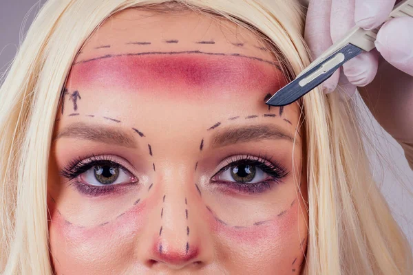 Csinos szőke Barbie nő orvosi kozmetikusok kezében fecskendők, hogy botox injekció az arcába closeup vonalak — Stock Fotó