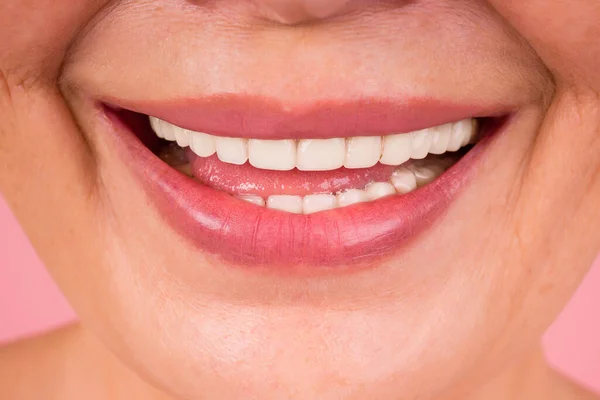 Close up άποψη για ανώτερες οδοντοστοιχίες, χείλη με ροζ κραγιόν. — Φωτογραφία Αρχείου