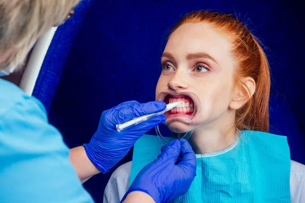 Gyönyörű vörös hajú gyömbér nő nyitott szájjal és szájfeltéttel a fogorvosnál műanyag fehérítő tálcát visel — Stock Fotó