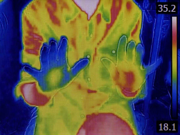 Hands Infrared Thermovision — Stock Photo, Image