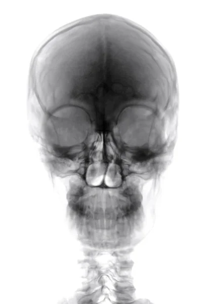Corte de rayos X de cabeza humana — Foto de Stock