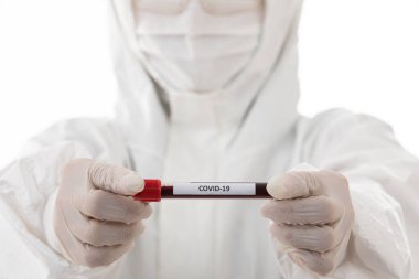 Steriliz laboratuvar önlüğü giyen bilim adamı elinde Covid-19 test tüpü örneği tutuyor. Virüsün adı üzerine seçici odaklanma. Coronavirüs 'ü yenmek için araştırma yapan tıp insanları için konsept.