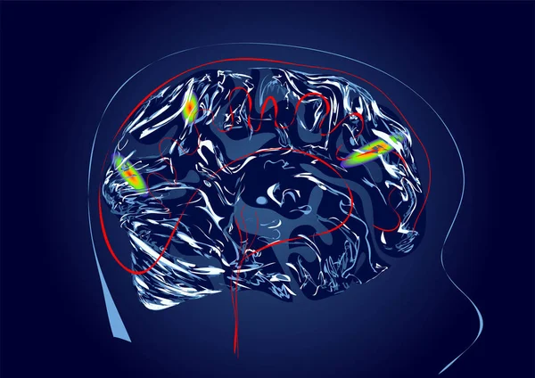 Векторная иллюстрация мозга — стоковый вектор