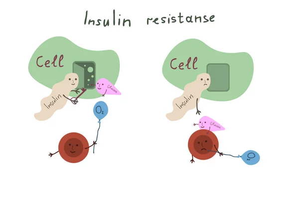 Ilustração Vetor Dos Desenhos Animados Resistência Insulina — Vetor de Stock