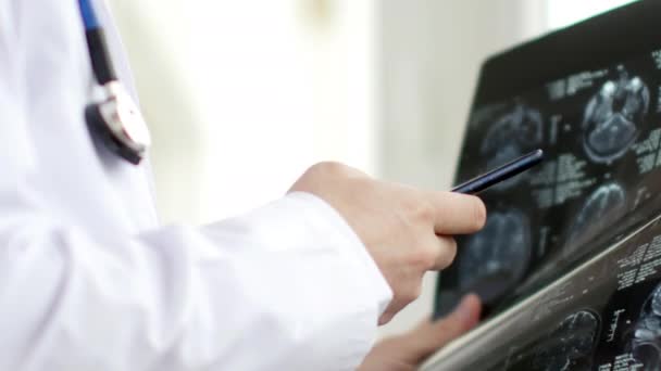 O médico vê a ressonância magnética e escreve SMS para alguém. 4K UltraHD de vídeo — Vídeo de Stock