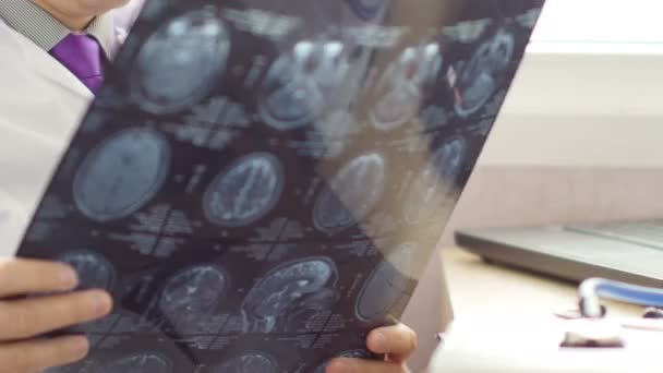 의료 의사가 뇌 Mri 검사를 분석입니다. Ultrahd 비디오 — 비디오