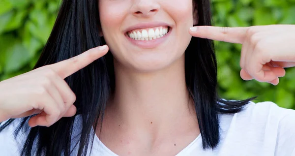 Mujer mostrando sus dientes perfectos — Foto de Stock