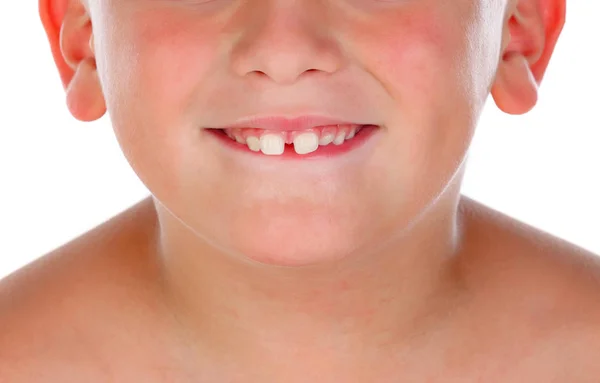 Милий Хлопчик Великими Новими Зубами Посміхається Ізольовано Білому Тлі — стокове фото