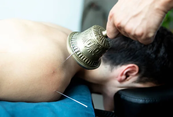 Hombre joven en una acupuntura y terapia de sonido — Foto de Stock