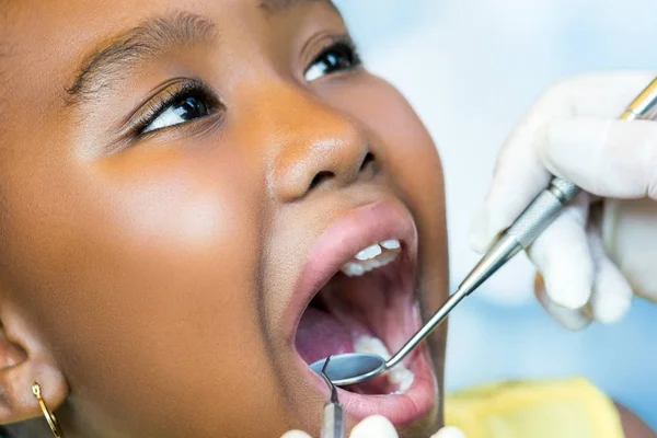 Afrikaanse kereltje bij tandheelkundige checkup. — Stockfoto