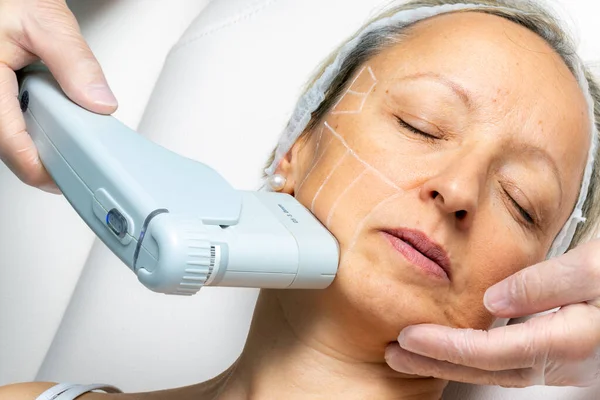 Top View Middle Aged Woman Having Cosmetic Facial High Intensity — Stock Photo, Image