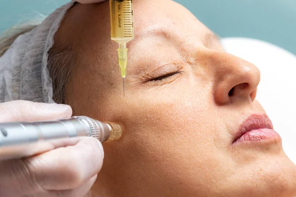 Macro Close Terapeuta Injetando Enzimas Com Caneta Derma Torno Dos — Fotografia de Stock