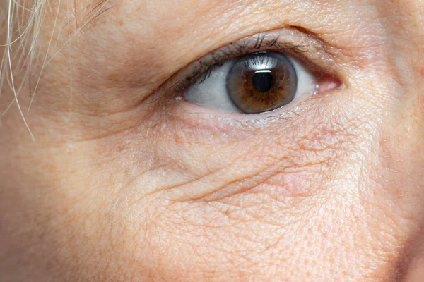 Extreme Close Detail Eye Wrinkles Sagging Skin Middle Aged Woman — Stock Photo, Image