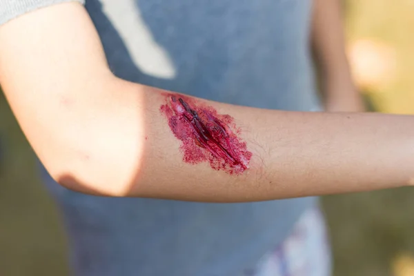 Çocuk Asya, kolundaki yara sahte giysi yara özel efekt, seçici odak