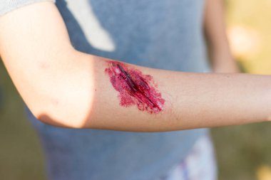 Çocuk Asya, kolundaki yara sahte giysi yara özel efekt, seçici odak