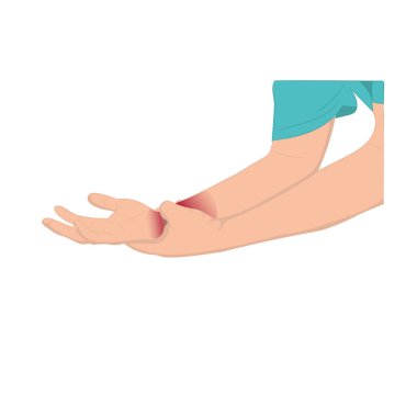 Bileğindeki ağrı, bilek bölgesindeki bağ dokusu, vektör illüstrasyon konsepti, hastalık ve sağlık sigortası yüzünden adamın bileğinde ağrı var.