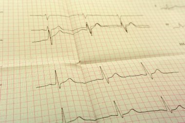 Eggor EKG Efor testi ve pembe kalp hapları formsuz sonucu kağıt EKG olduğunu. İnsanlar kavramı yüksek veya daha büyük kalbini kontrol etmek için promosyon paketi.