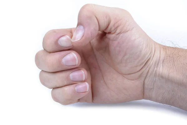 Мужская Рука Белого Цвета Ногти Белом Фоне — стоковое фото