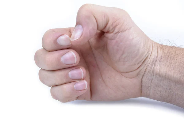 Caucasiano Mão Masculina Mostrando Unhas Fundo Branco — Fotografia de Stock