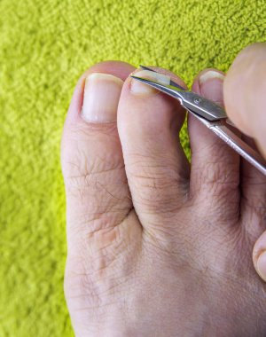 Tırnaklar insan ayağında, makaslar yeşil havluda.