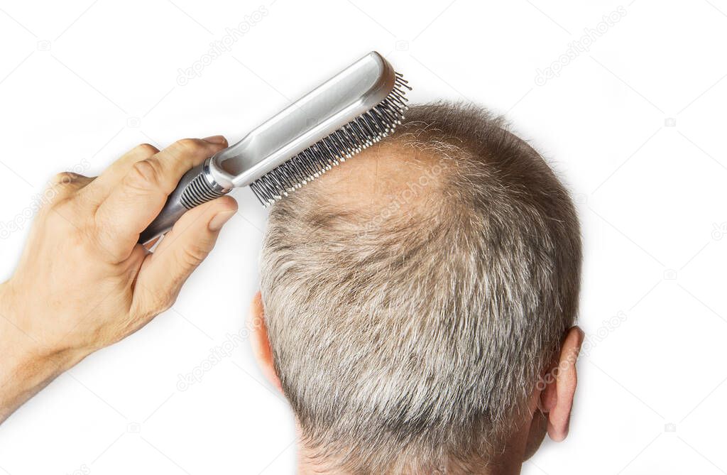 Bald man with comb. Hair Loss concept