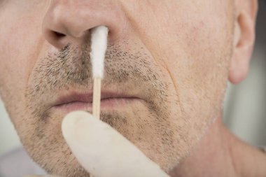 Burundan virüs testi örneği alıyorum.