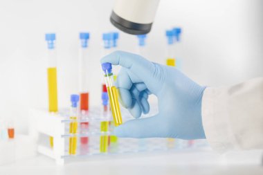 Eldivenli bir elin, sarı sıvıyla dolu cam bir test tüpünü tutarken yakın plan çekilmiş ve arkada test tüpleri var. Araştırma konsepti.