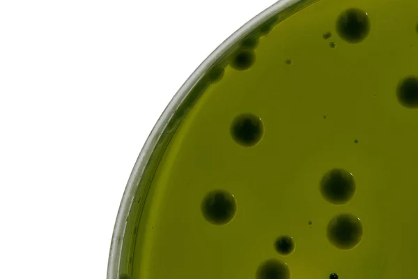 Zbliżenie do płytki wzrostu kultury bakterii na pożywkach selektywnych, — Zdjęcie stockowe