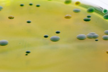 Tatlı tabağı bakteri kültürü büyüme seçmeli medya, vi