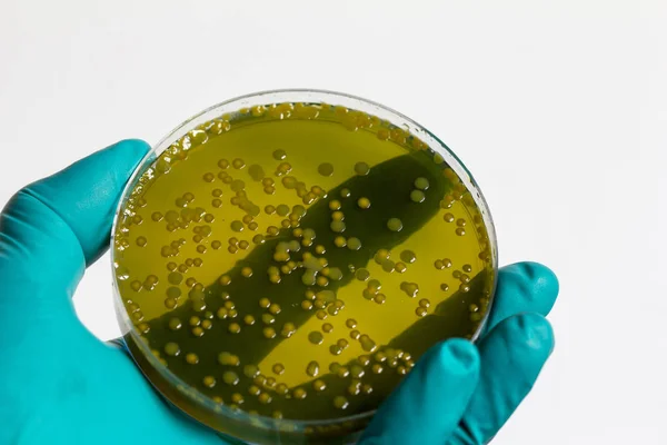 Zbliżenie na płytki wzrostu kultury bakterii na pożywkach selektywnych, vi — Zdjęcie stockowe